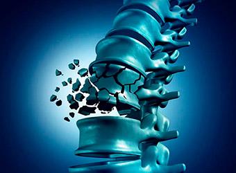 banner cifoplastia-e-vertebroplastia