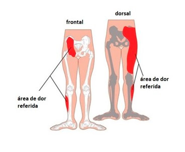 Dor frontal e dorsal