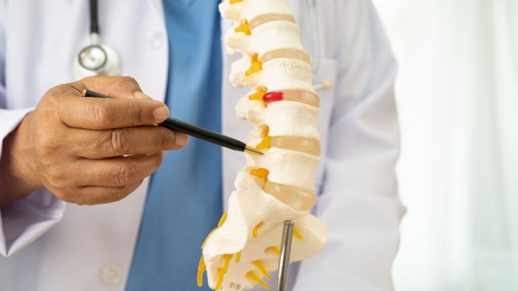 médico apontando com uma caneta para uma parte específica de um protótipo da coluna vertebral